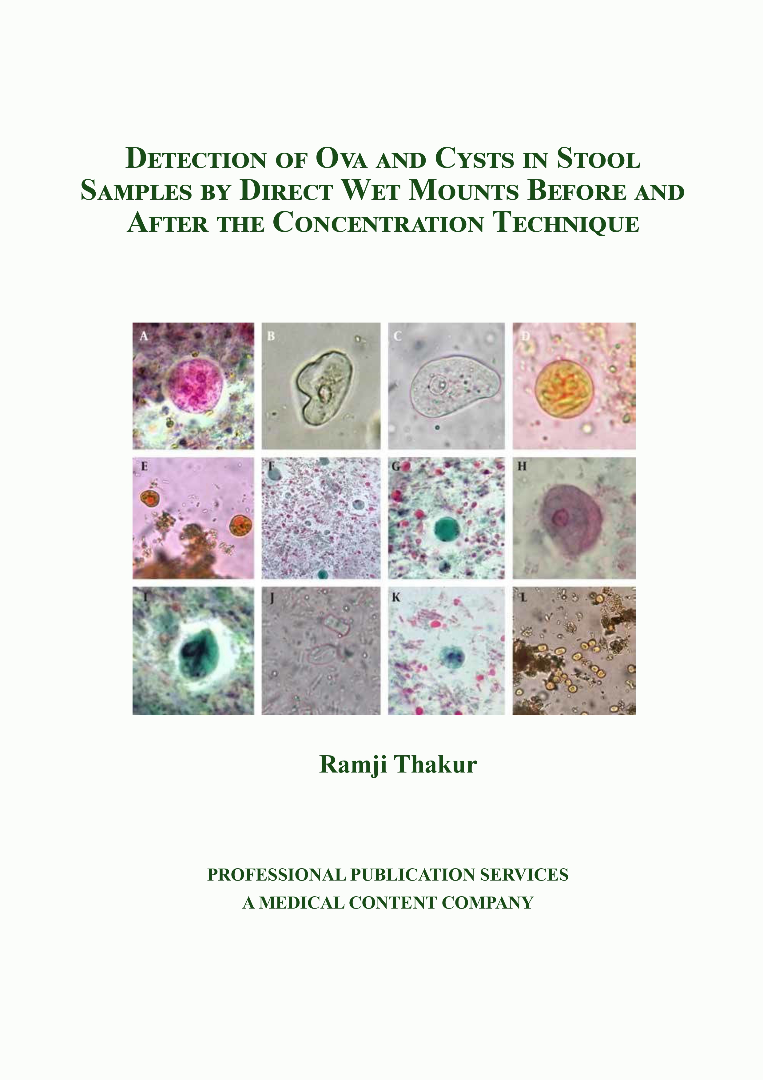 Detection of Ova and Cysts in Stool Samples by Direct Wet Mounts Before and After the Concentration Technique